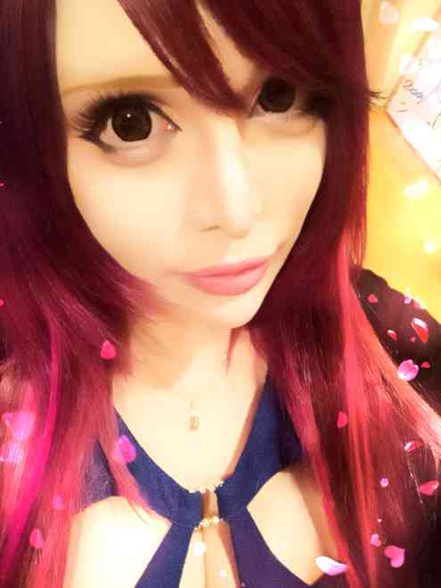 ヴァニラの整形を医師5人止める…本人は「顔削りたい。まだやりたいです」