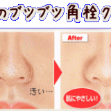 肌が汚い女 に対する男性の本音が判明ｗｗｗｗのトピックの画像一覧 ガールズちゃんねる Girls Channel