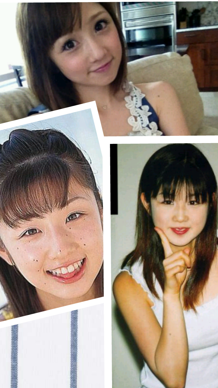 ゆうこりん 整形