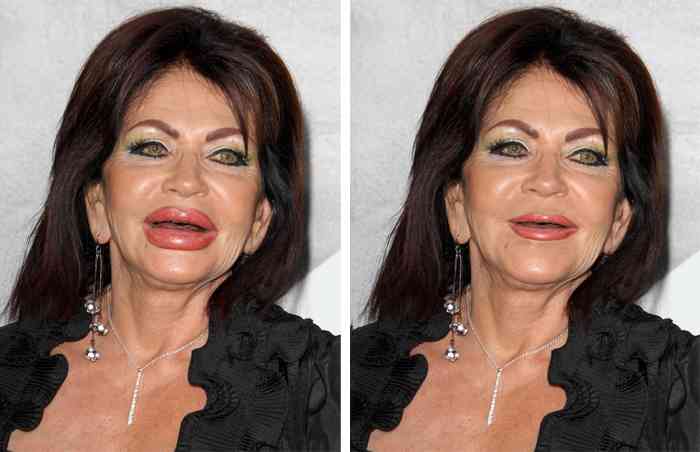 シルヴェスター・スタローンの91歳美容整形母、そのお達者ぶりに唖然！