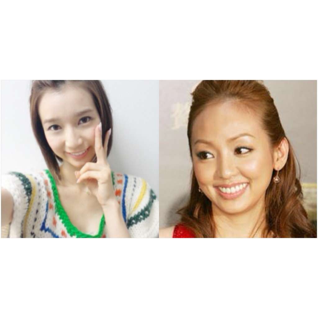 平野綾のデコがいよいよヤバい件
