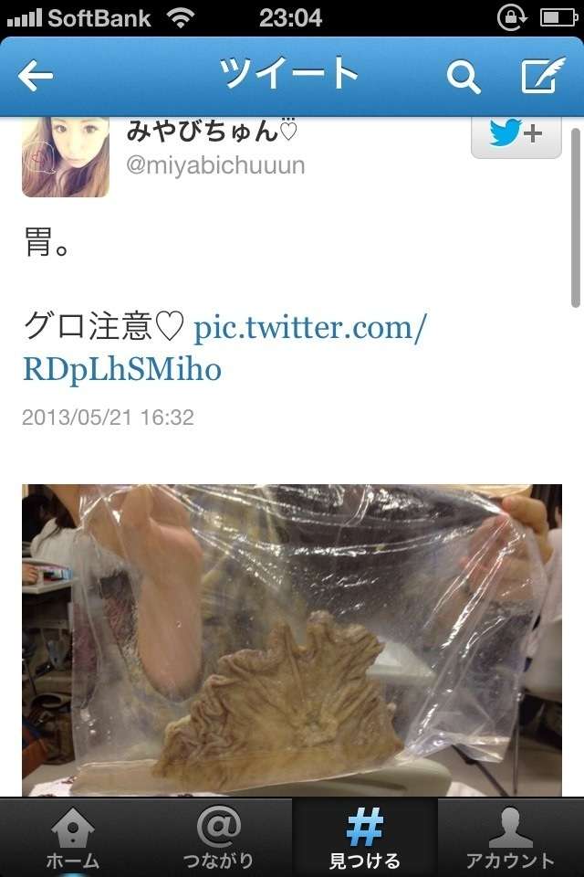 看護大生がTwitterで患者の臓器晒す