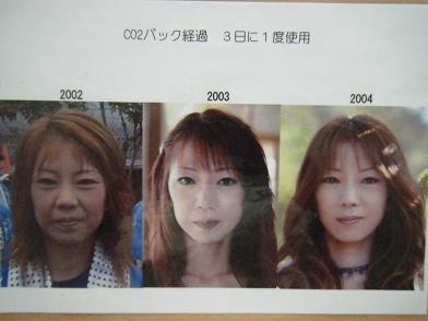明らかに別人（物）！突っ込みたくなるBefore＆After挙げて下さい！！