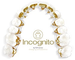 大人になって歯科矯正した方、しようと考えている方☆