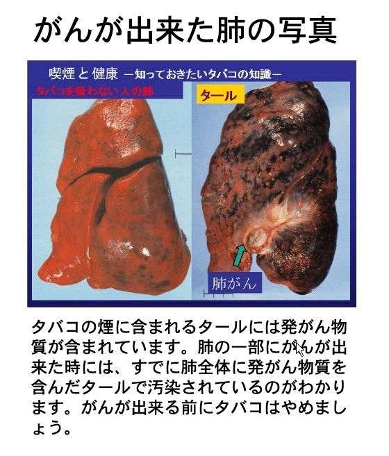 禁煙に成功したのに、また吸いたい欲求が…
