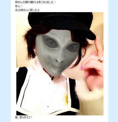 加藤茶の嫁・綾菜の顔の不自然な膨張に囁かれる“整形後のダウンタイム”