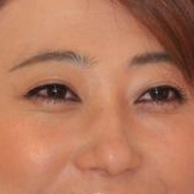 板野友美の“作られた感“は不幸!? 芸能界で成功する「幸せな整形」とは?
