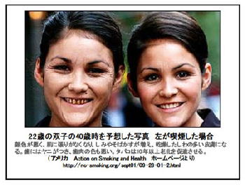 沢尻エリカ(28)の最新画像の口元が酷いと話題に