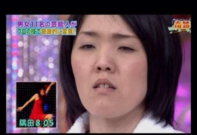 眼瞼下垂の人 ガールズちゃんねる Girls Channel