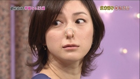 首のしわありますか?