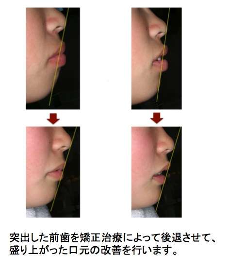 第一印象で大切なところ