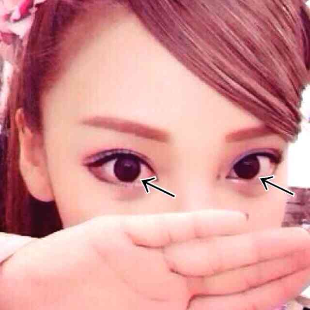 ざわちん、視力低下しメガネデビュー!←メガネ画像がヤバすぎる件