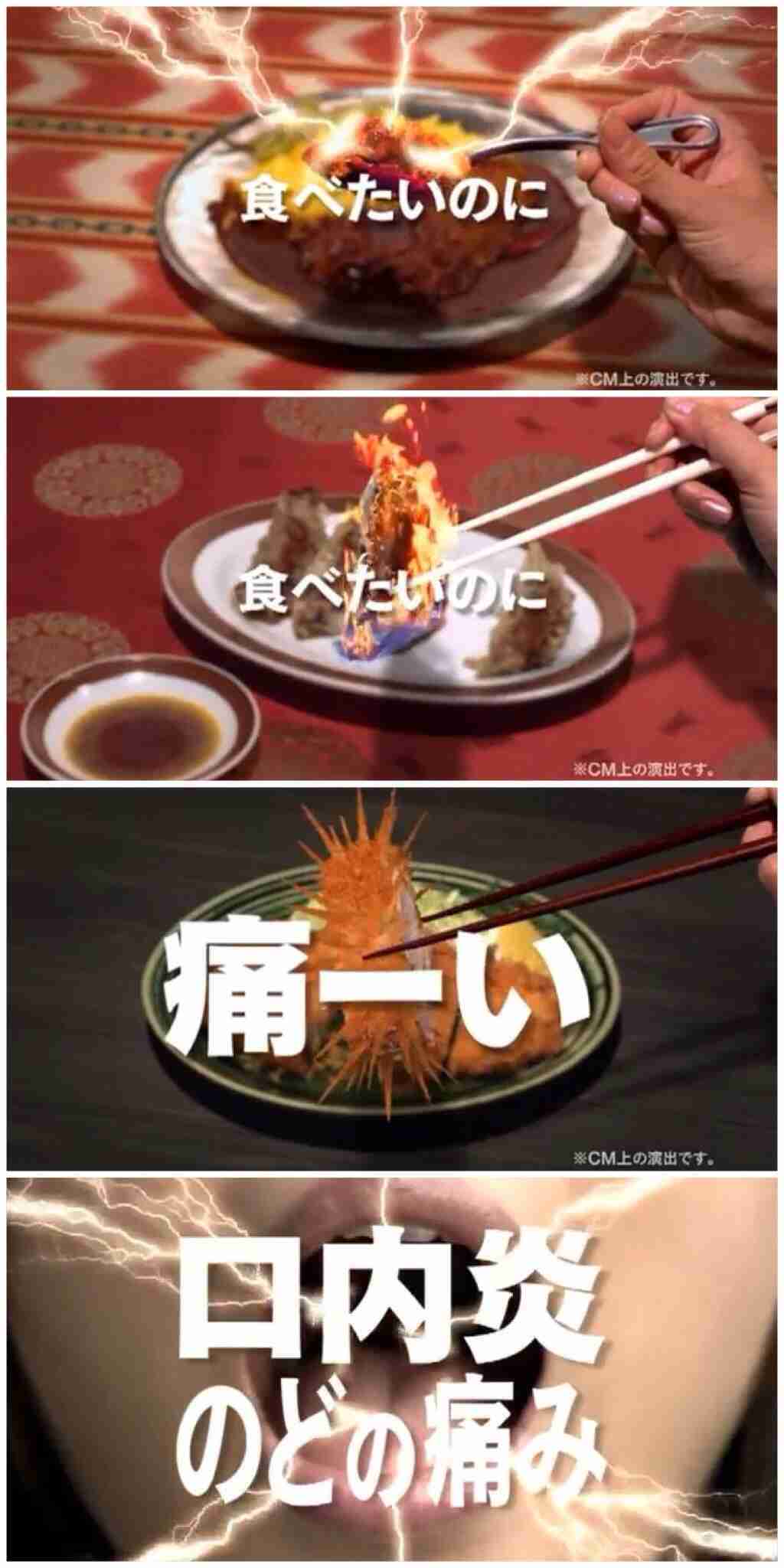 口内炎よくできる人