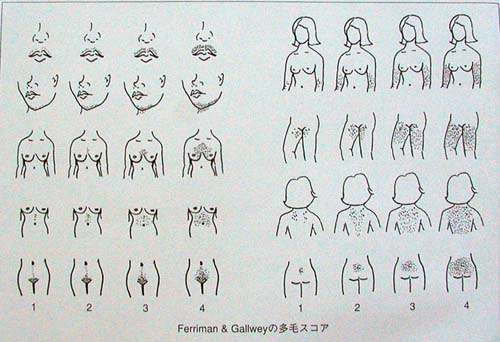 足の毛が男子なみに濃い方～(笑)