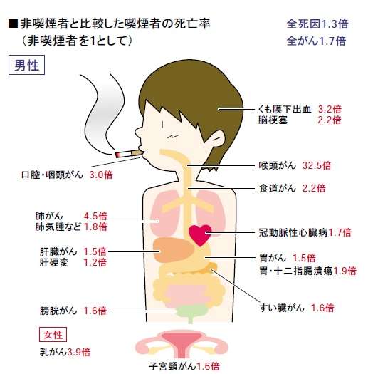 禁煙で肺がん増加？「たばこ以外の肺がんになる要因を追究すべき」と識者