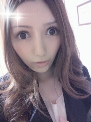 二重の整形した方!