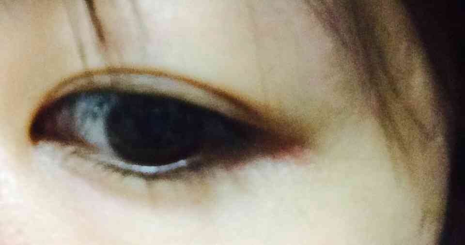 二重の整形した方!