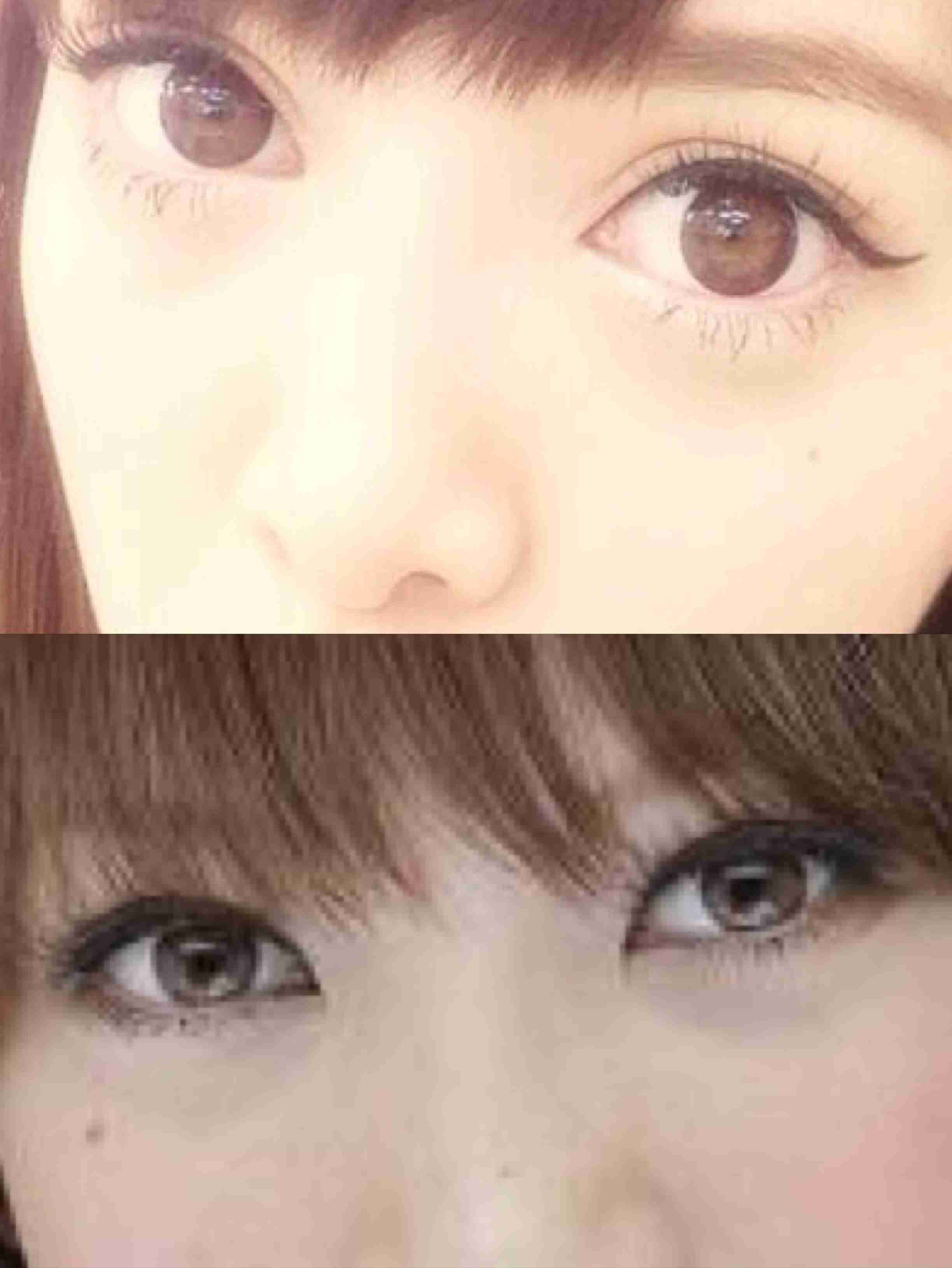 二重の整形した方!