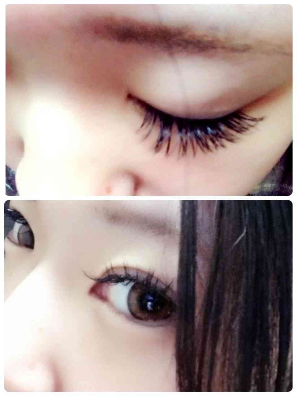 二重の整形した方!