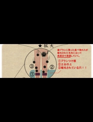 歯ブラシどのくらいの頻度で変えますか？