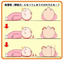 頭が絶壁の方 ガールズちゃんねる Girls Channel