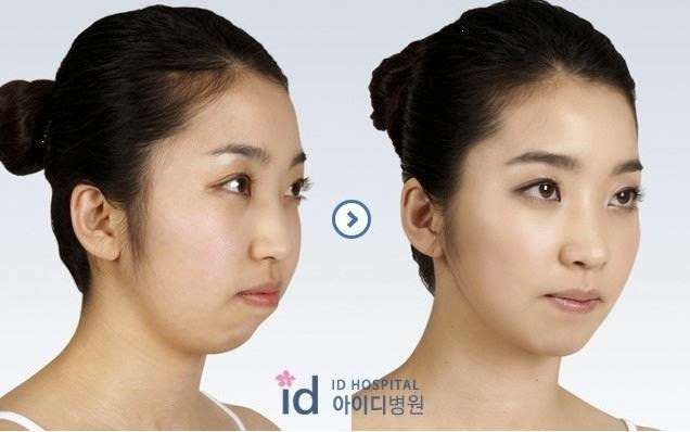 ガルちゃんで画像(サイト)を貼り付ける方法＆練習Part3