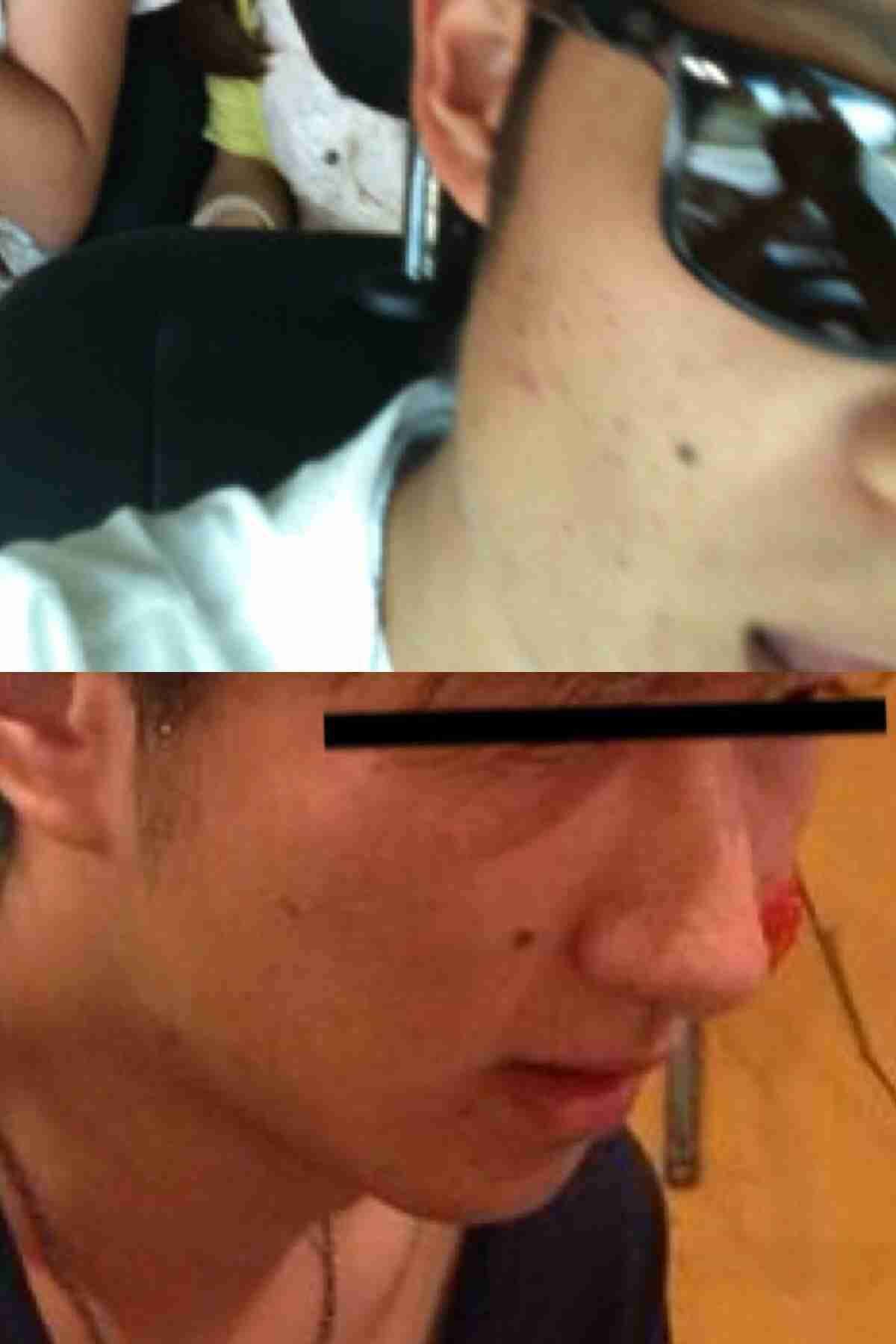 女子大生集団昏倒事件につき明治大学がコメント「薬物などの事件性なし」クライスは公認取り消し、廃部に