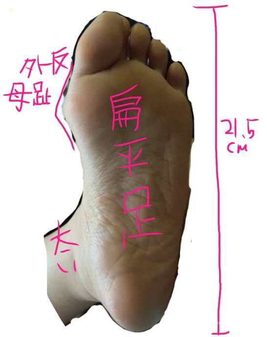 足の悩み