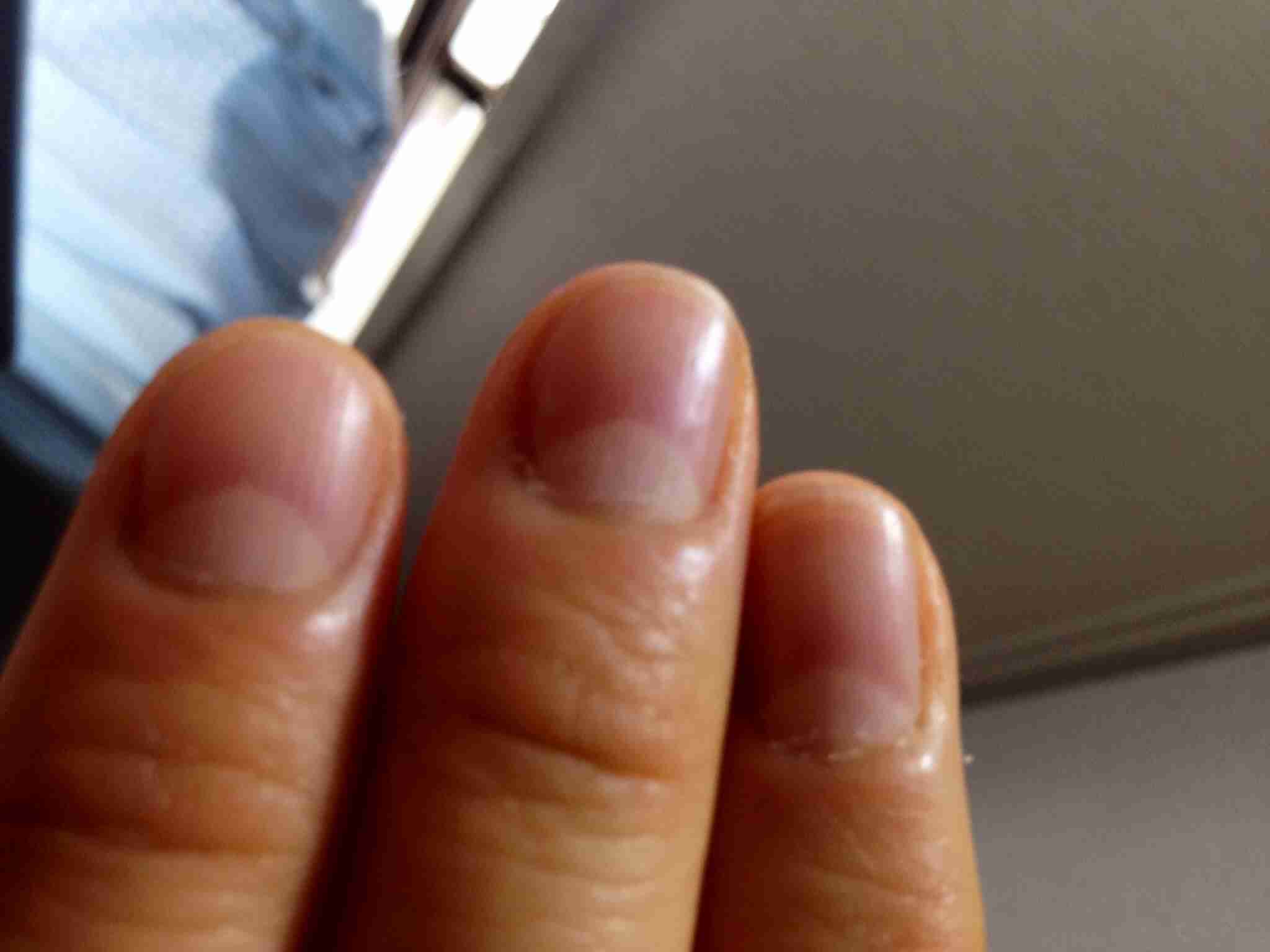 爪の形が悪い人 ガールズちゃんねる Girls Channel