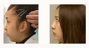 凹凸のない顔立ちの方居ますか？