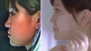 凹凸のない顔立ちの方居ますか？