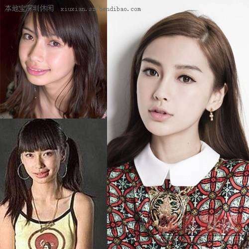 美容整形でなりたい芸能人1位は?
