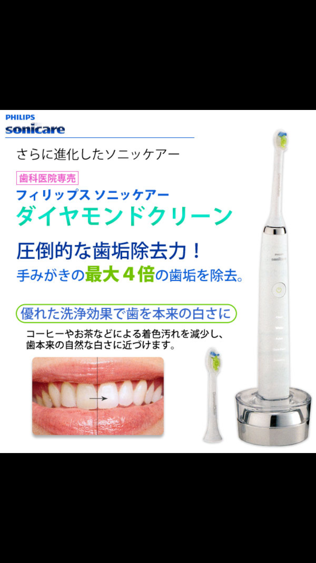 おすすめの歯ブラシは何ですか???