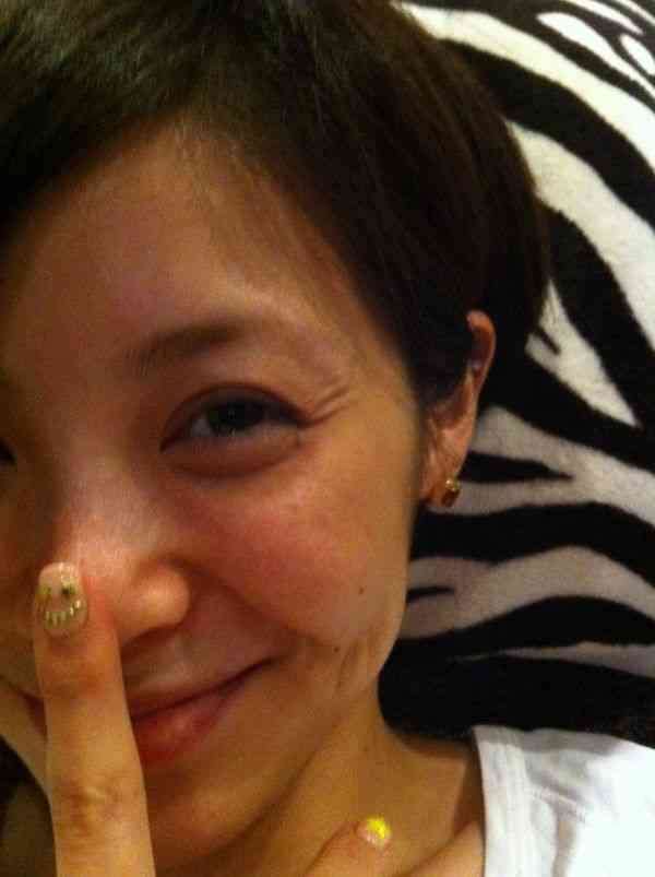 松浦亜弥大喜び！年内ママに！妊娠が子宮内膜症“最善の治療”に