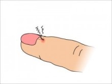 直したい癖を直せた人～