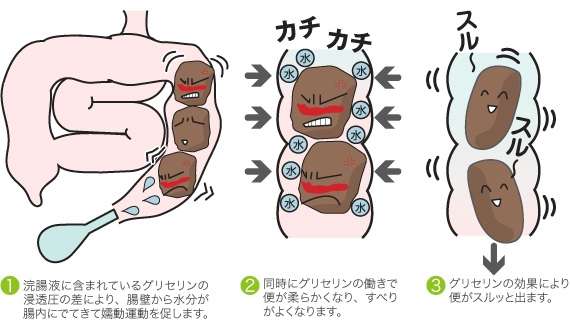 便秘の人
