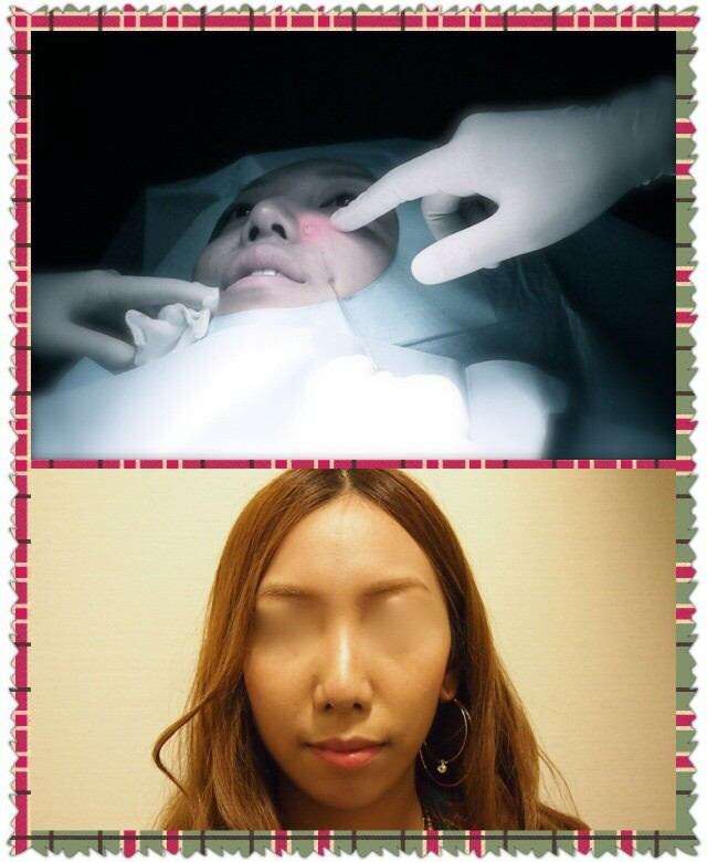 ざわちん、ネットの誹謗中傷に苦悩「マスク外すのが怖い」