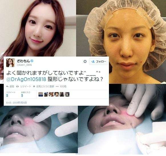 ざわちん、ネットの誹謗中傷に苦悩「マスク外すのが怖い」