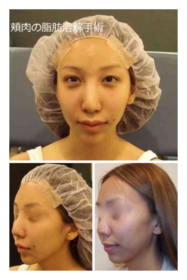 ざわちん、ネットの誹謗中傷に苦悩「マスク外すのが怖い」