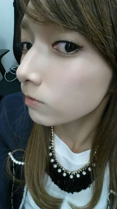 後藤真希、顔のやけどが悪化…