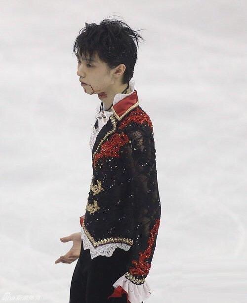 【フィギュア】羽生結弦、全治2～3週間…診断結果発表