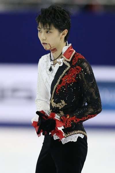 【フィギュア】羽生結弦、全治2～3週間…診断結果発表