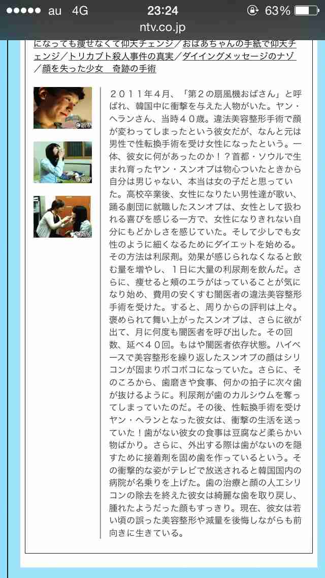最近、顔だけが太って見える…。これはただのむくみ? それとも何かの病気?