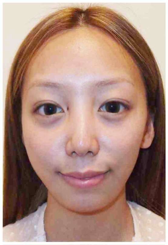 ざわちんが「風呂上がり姿」を公開し話題に