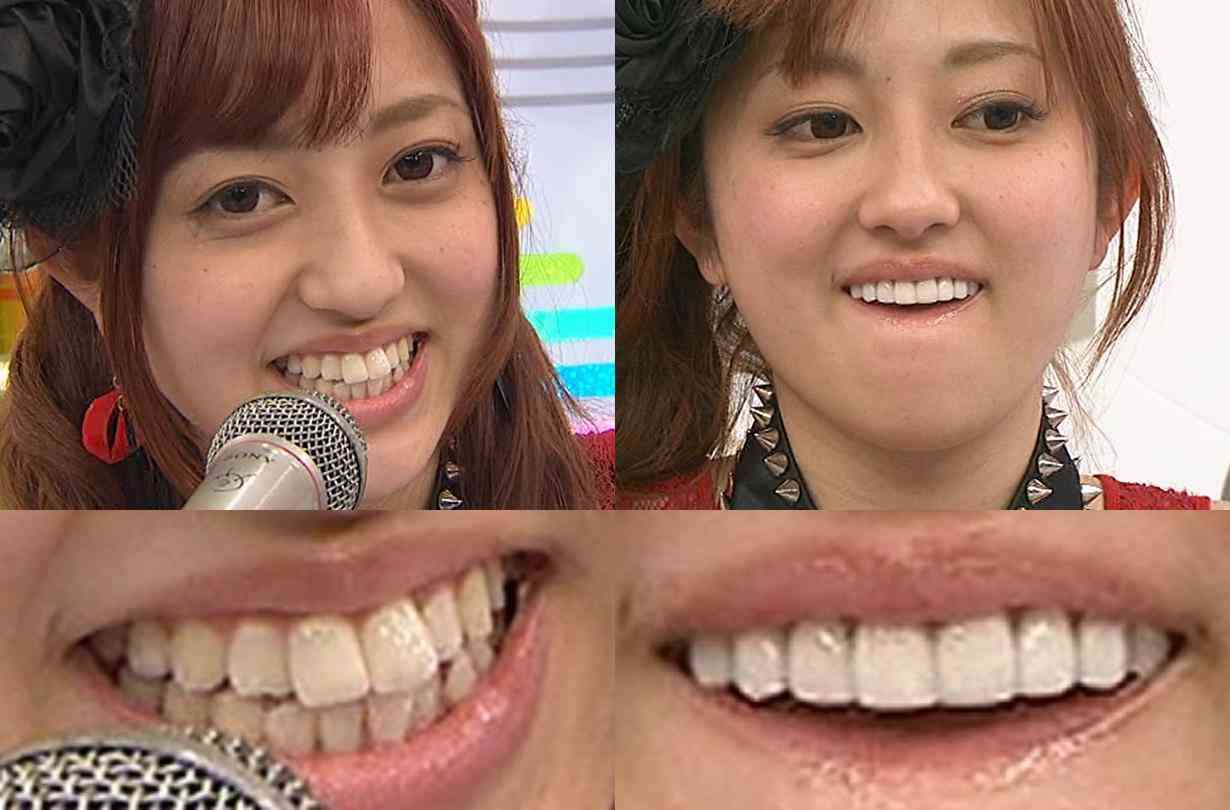 【閲覧注意】菊地亜美が衝撃的な変顔披露！ 魔除けになるほど強烈？
