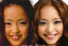 逆に整形してよかったじゃんと思う芸能人は？