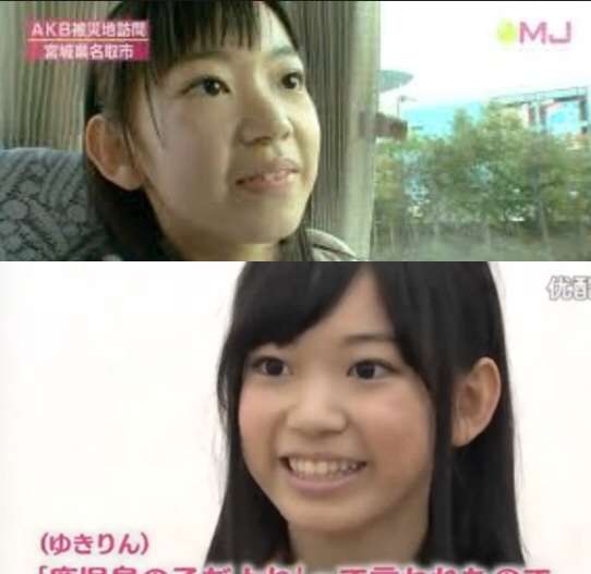 逆に整形してよかったじゃんと思う芸能人は？