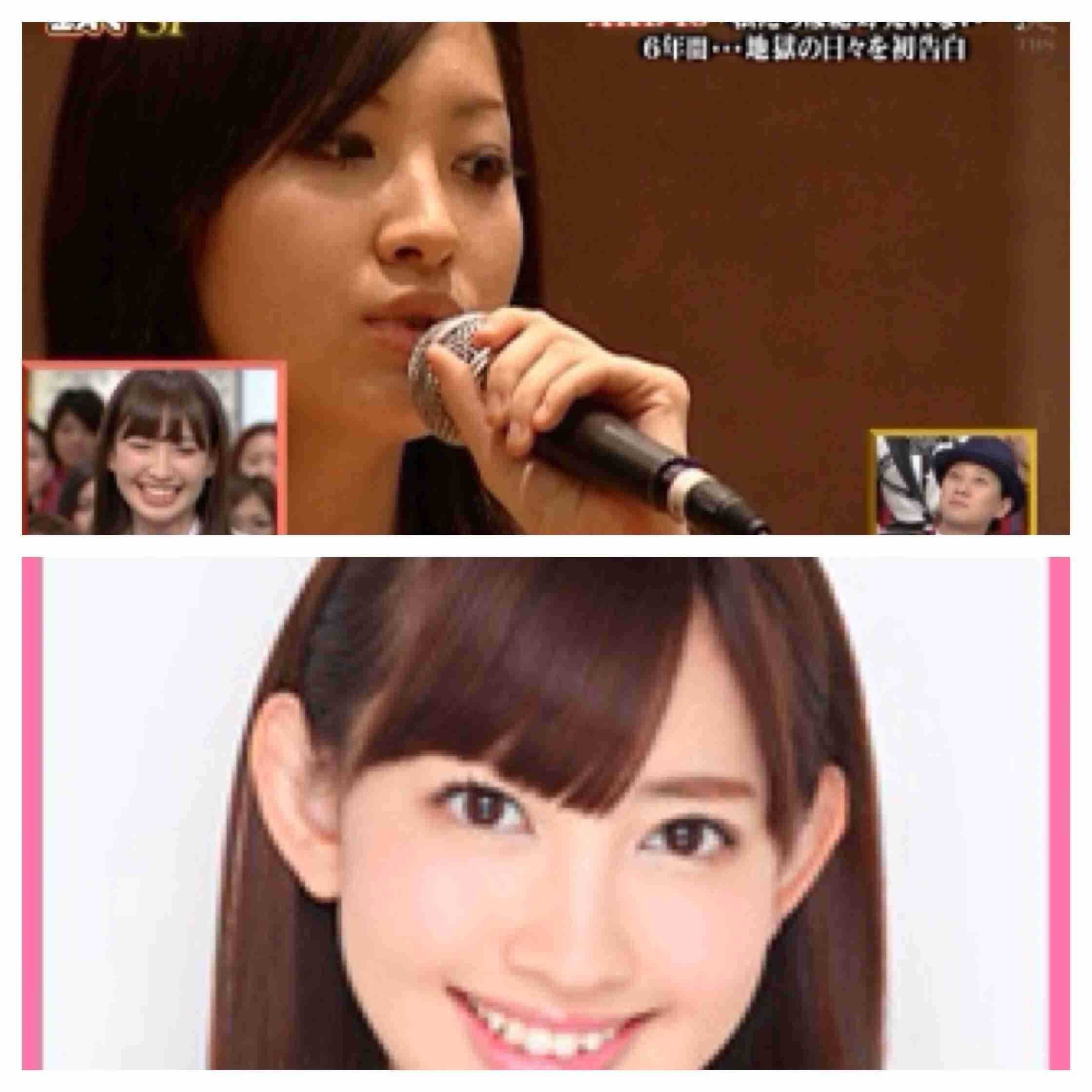逆に整形してよかったじゃんと思う芸能人は？