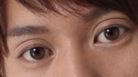 逆に整形してよかったじゃんと思う芸能人は？