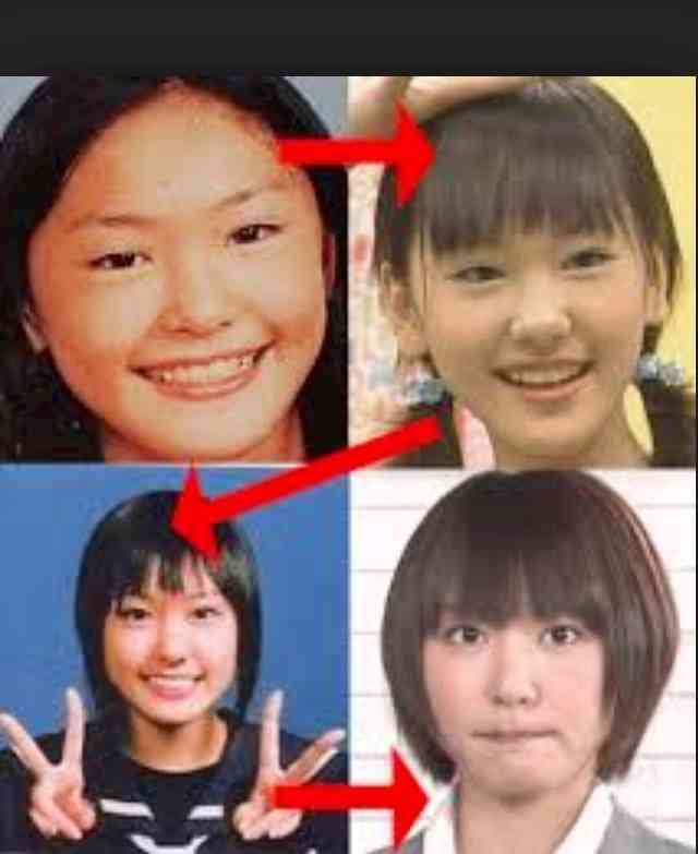 逆に整形してよかったじゃんと思う芸能人は？